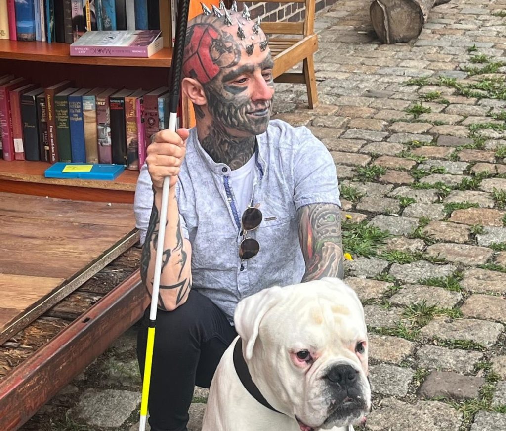 Blind man with tattooed black eyeballs reveals his extreme body mods turned into a nightmare after a metal head implant became so infected with pus it had to be surgically removed.