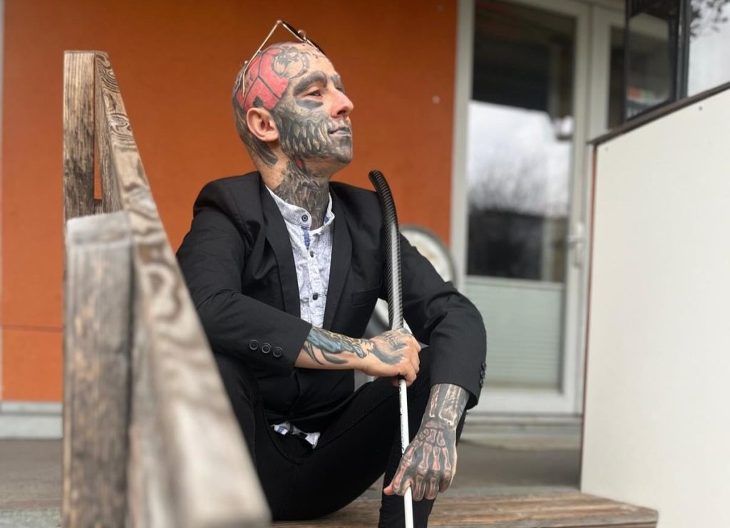 Blind man with tattooed black eyeballs reveals his extreme body mods turned into a nightmare after a metal head implant became so infected with pus it had to be surgically removed.