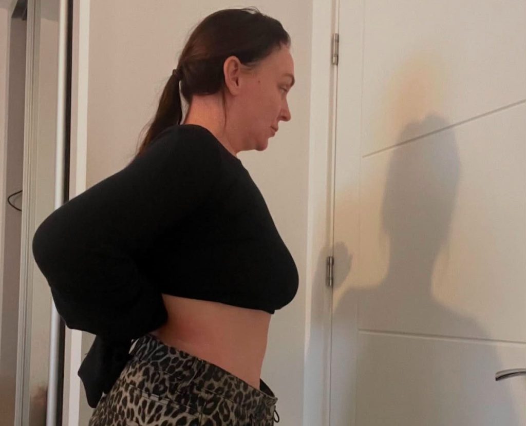 Woman whose hair fell out in clumps after taking Mounjaro says she has no regrets - despite sobbing in the shower as handfuls came away, having shed more than five stone.