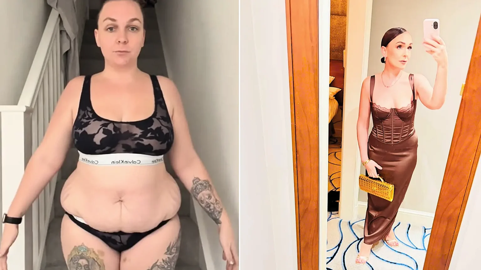 Woman whose hair fell out in clumps after taking Mounjaro says she has no regrets - despite sobbing in the shower as handfuls came away, having shed more than five stone.
