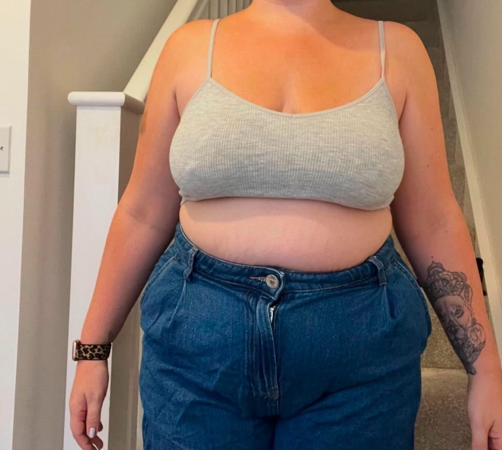 Woman whose hair fell out in clumps after taking Mounjaro says she has no regrets - despite sobbing in the shower as handfuls came away, having shed more than five stone.