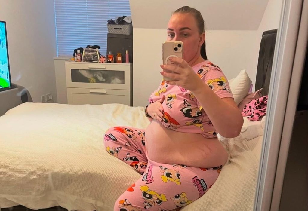 Woman whose hair fell out in clumps after taking Mounjaro says she has no regrets - despite sobbing in the shower as handfuls came away, having shed more than five stone.