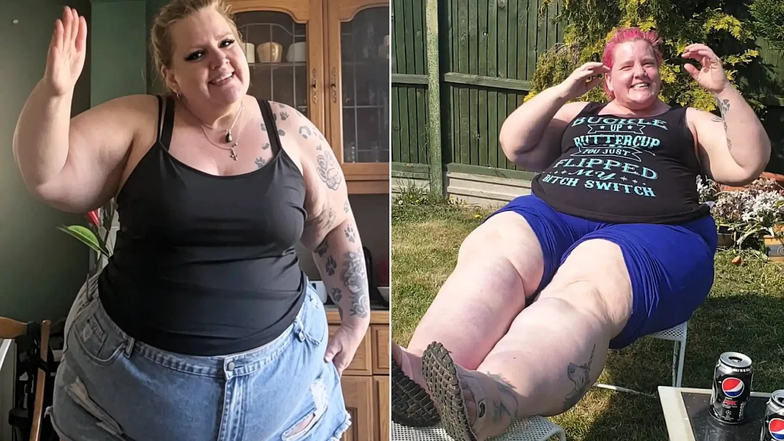Mum who hit 30st and watched her legs balloon while eating salads was told to diet for years by doctors who missed the real cause - a chronic illness called lymphoedema.