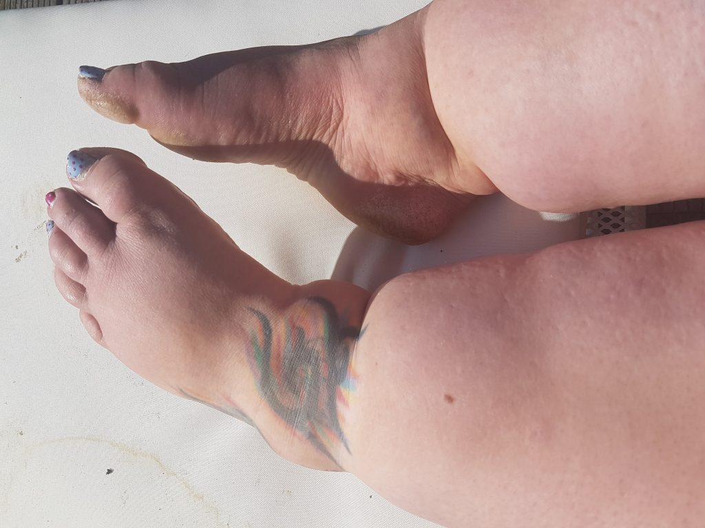 Mum who hit 30st and watched her legs balloon while eating salads was told to diet for years by doctors who missed the real cause - a chronic illness called lymphoedema.