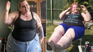 Mum who hit 30st and watched her legs balloon while eating salads was told to diet for years by doctors who missed the real cause - a chronic illness called lymphoedema.