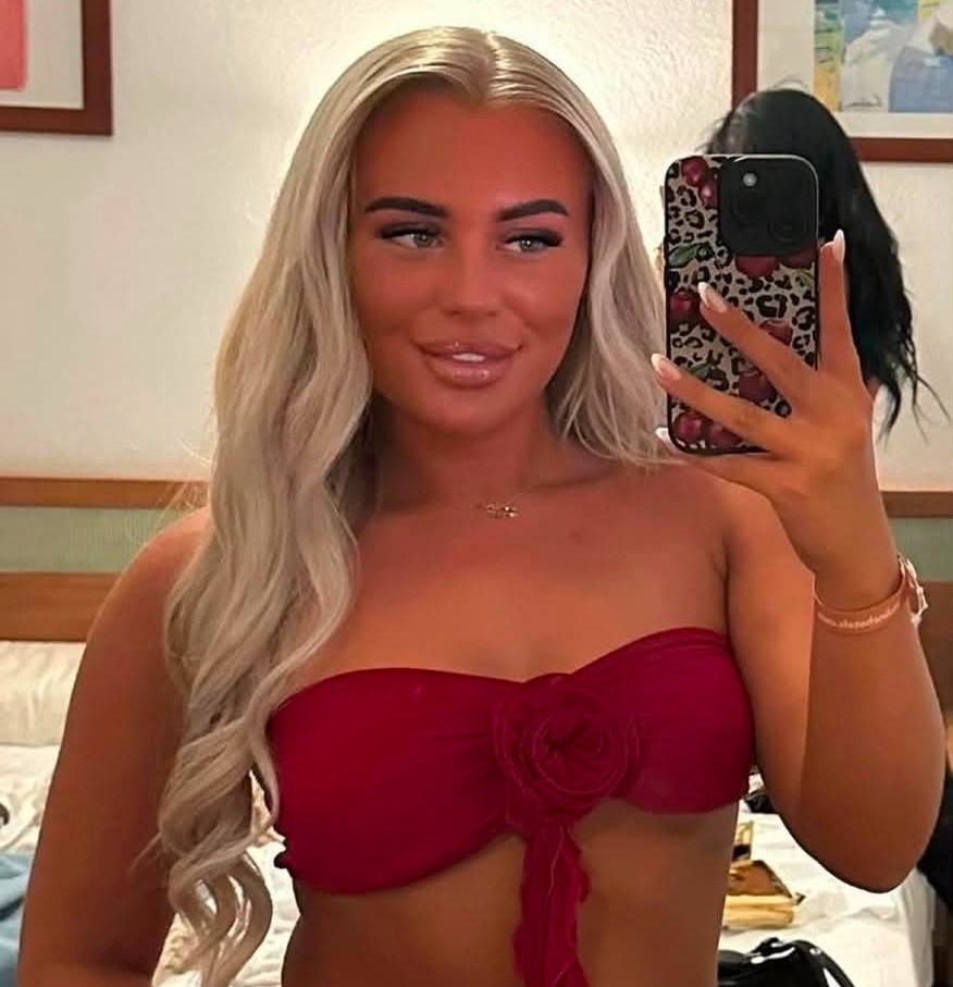 'Sunbed addict' diagnosed with melanoma at 22 after ignoring doctors who told her not to remove a mole - she now warns tanning beds should be banned.