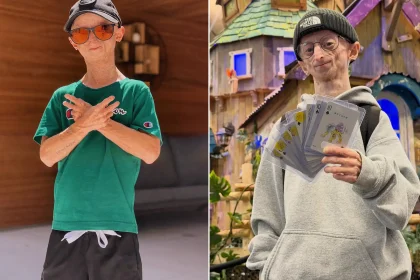 Influencer Michiel Vandeweert, who had rare 'Benjamin Button' disease, has died aged 28, defying doctors who predicted he would not live beyond his 12th birthday.