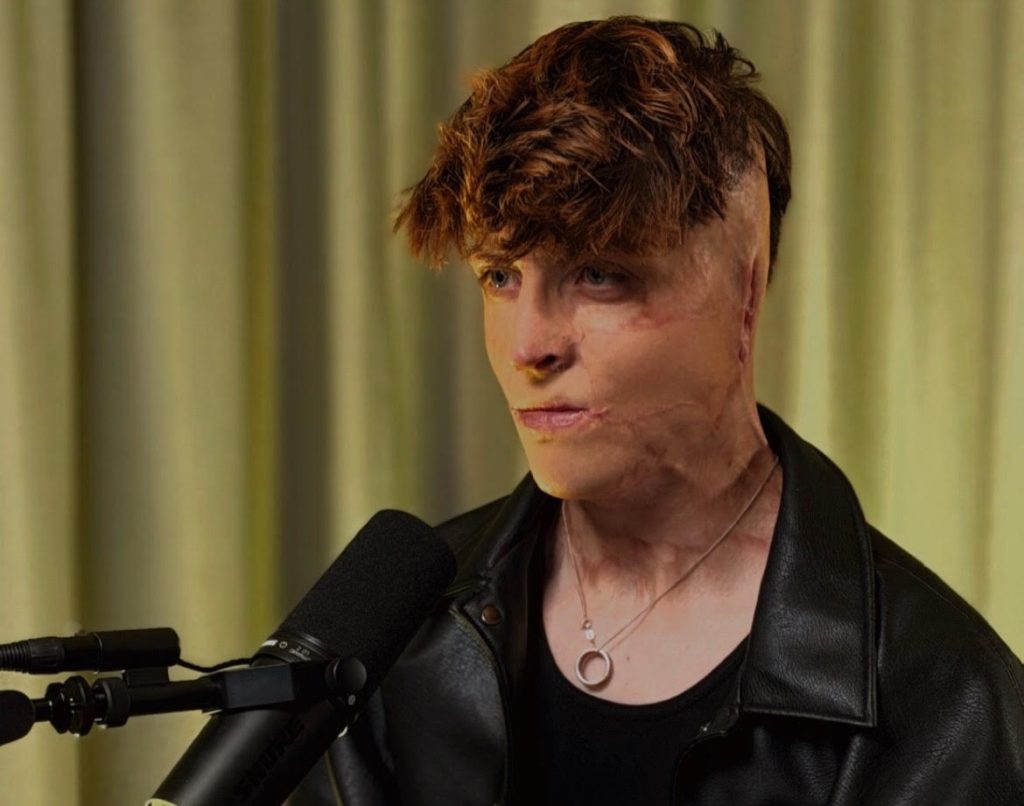 Teenager left with burns across 38% of his body after his father set off gas cylinders in the family car is now chasing his acting dream on red carpets alongside Hollywood stars.
