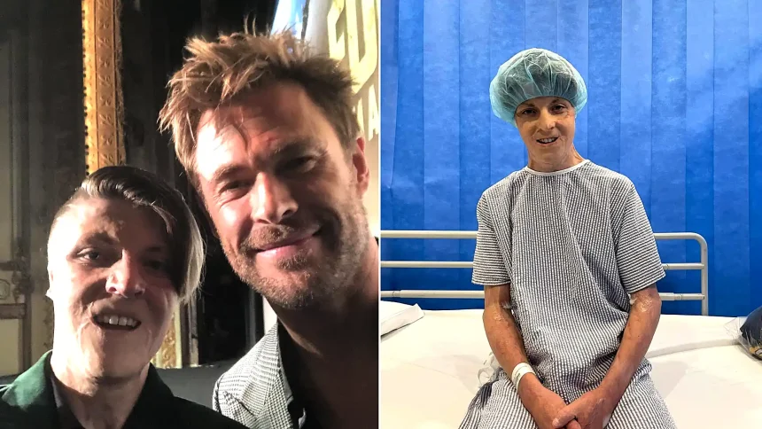Teenager left with burns across 38% of his body after his father set off gas cylinders in the family car is now chasing his acting dream on red carpets alongside Hollywood stars.