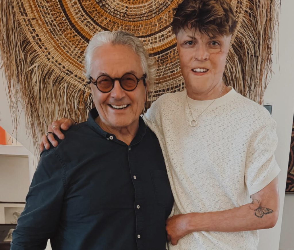 Teenager left with burns across 38% of his body after his father set off gas cylinders in the family car is now chasing his acting dream on red carpets alongside Hollywood stars.
