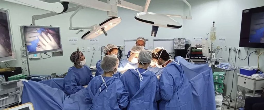 Conjoined twins joined at the head have died after the final stage of a complex 15-hour separation surgery - having been successfully separated hours earlier.
