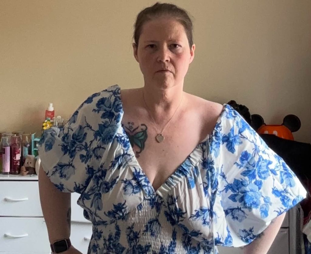 Woman who once ate 10 packets of crisps a day says she can finally fit on theme park rides after losing an incredible 17 stone through gastric bypass surgery.
