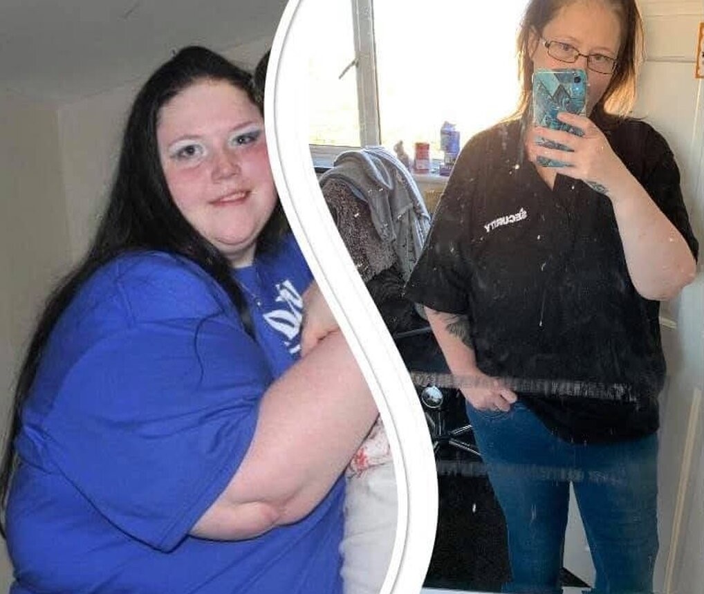 Woman who once ate 10 packets of crisps a day says she can finally fit on theme park rides after losing an incredible 17 stone through gastric bypass surgery.