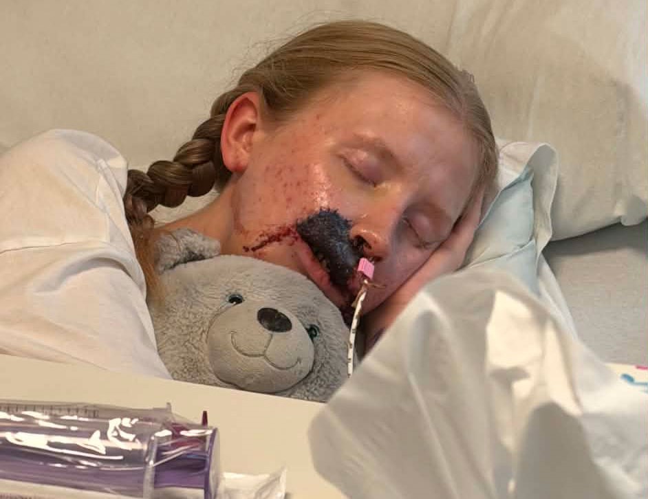 Woman, 20, faces years of surgery after a dog she had known since it was a puppy latched onto her face - she says the attack lasted just ten minutes.