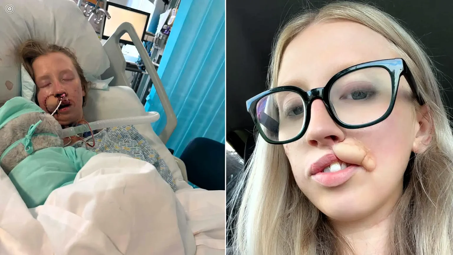Woman, 20, faces years of surgery after a dog she had known since it was a puppy latched onto her face - she says the attack lasted just ten minutes.