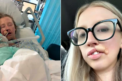 Woman, 20, faces years of surgery after a dog she had known since it was a puppy latched onto her face - she says the attack lasted just ten minutes.