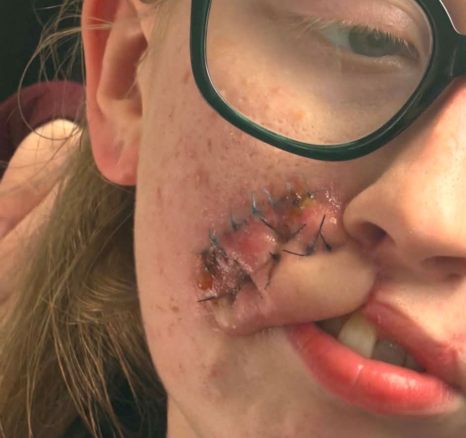 Woman, 20, faces years of surgery after a dog she had known since it was a puppy latched onto her face - she says the attack lasted just ten minutes.