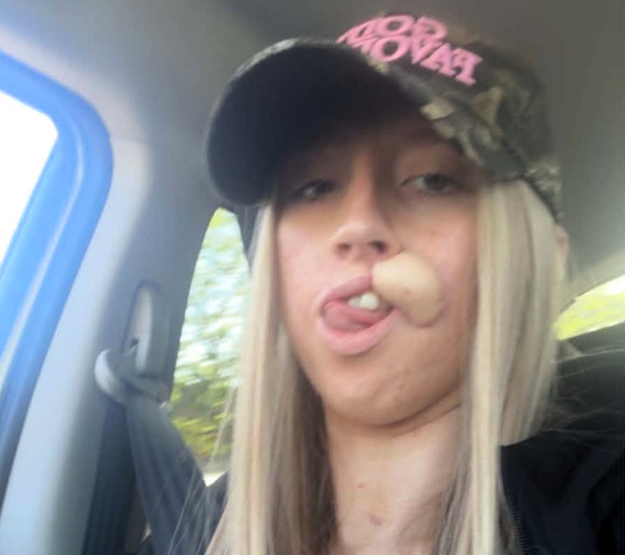 Woman, 20, faces years of surgery after a dog she had known since it was a puppy latched onto her face - she says the attack lasted just ten minutes.