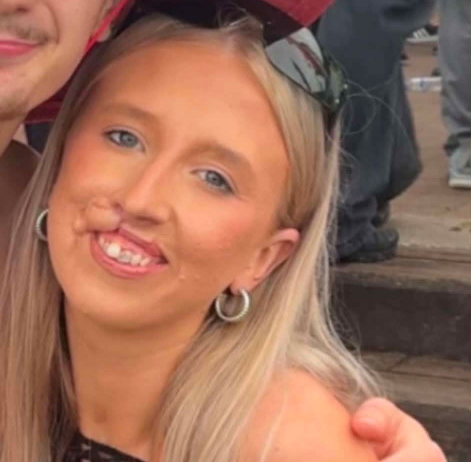 Woman, 20, faces years of surgery after a dog she had known since it was a puppy latched onto her face - she says the attack lasted just ten minutes.