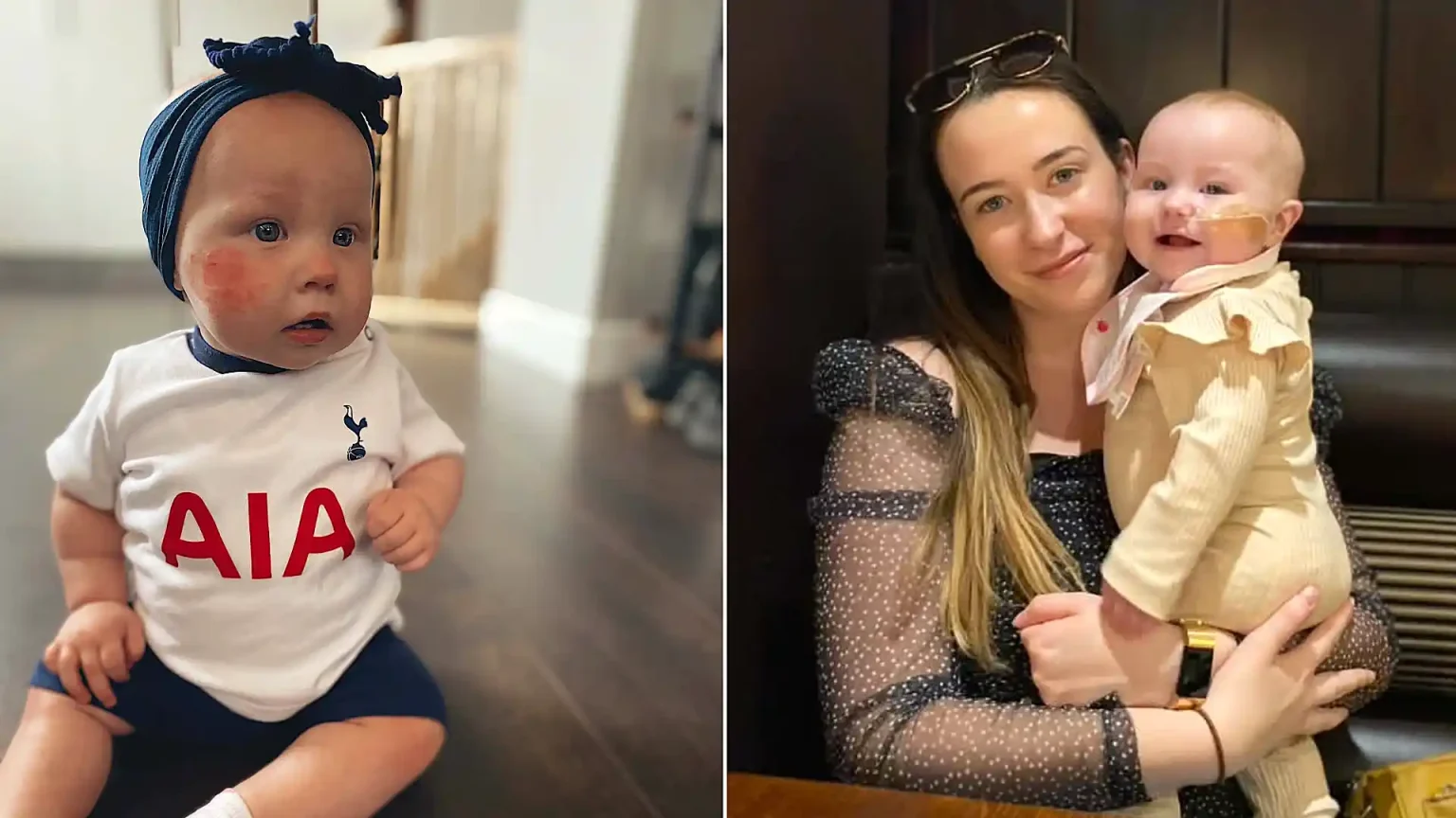 Grieving mum whose baby daughter's swollen tummy turned out to be aggressive stage 4 neuroblastoma urges parents to always trust their instincts - after losing Nellie aged 14 months.