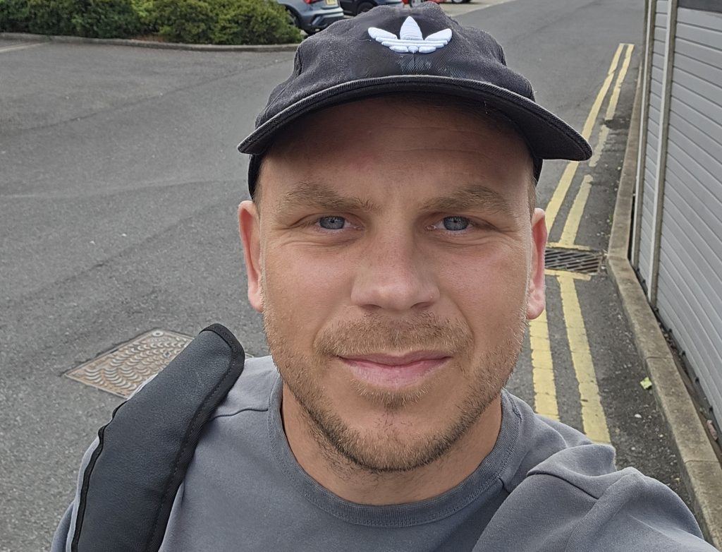 Recovering alcoholic who drank up to nine litres of cider a day was diagnosed with liver disease at 25 after spotting the whites of his eyes had turned a murky yellow in the mirror.