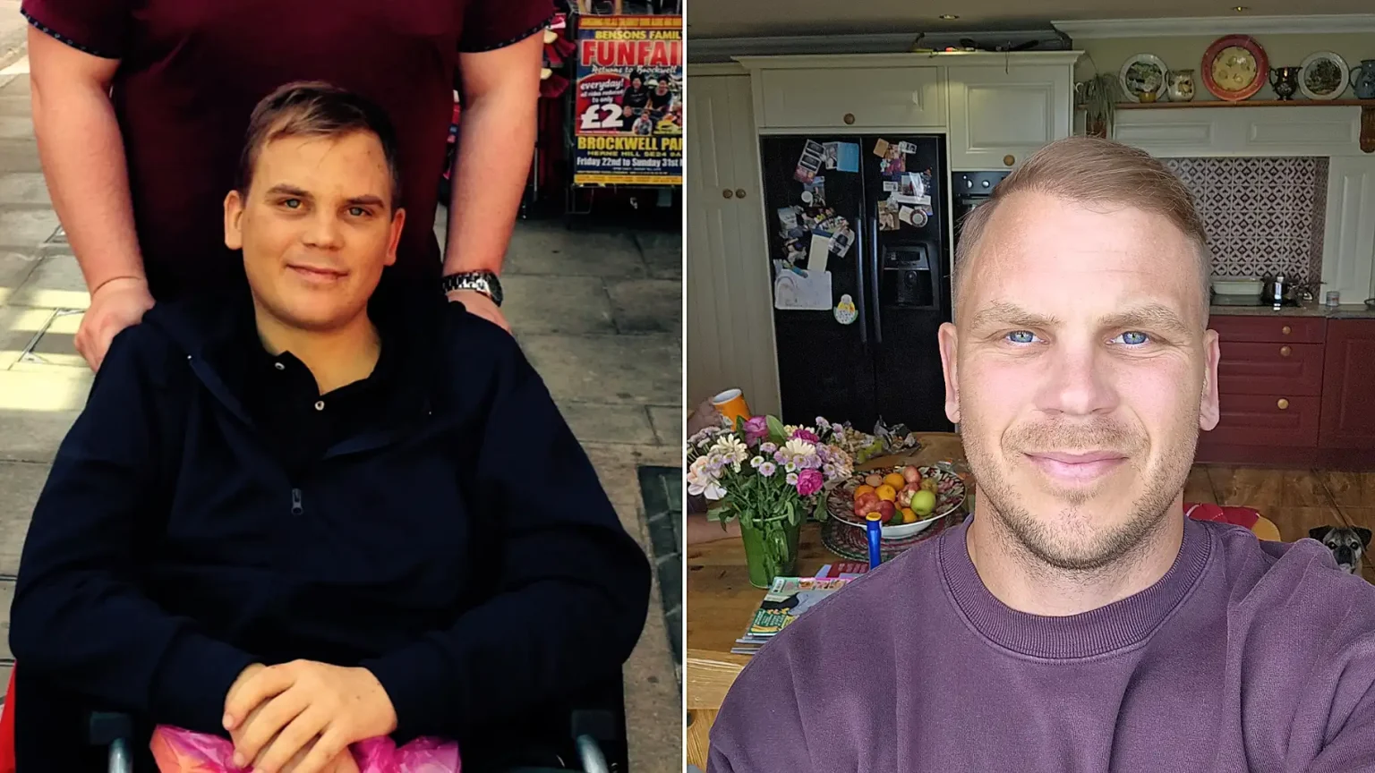 Recovering alcoholic who drank up to nine litres of cider a day was diagnosed with liver disease at 25 after spotting the whites of his eyes had turned a murky yellow in the mirror.