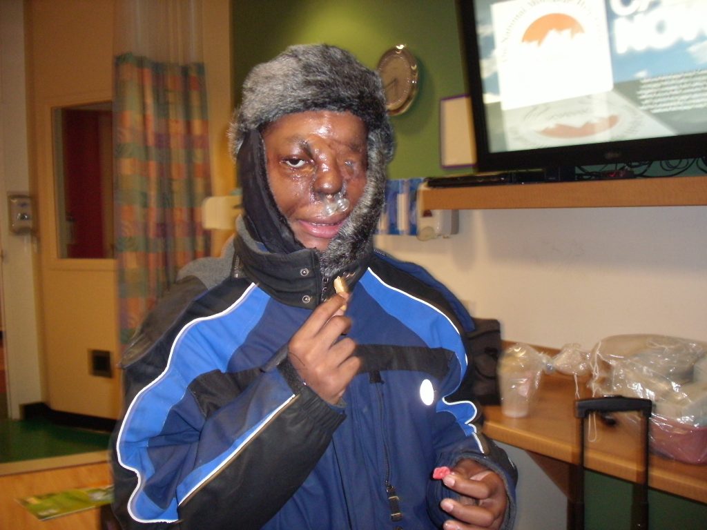 Man who grew up sleeping beside his dogs reveals the horror moment two pitbulls mauled his face - leaving him without his nose and ears after a 26-hour surgery.