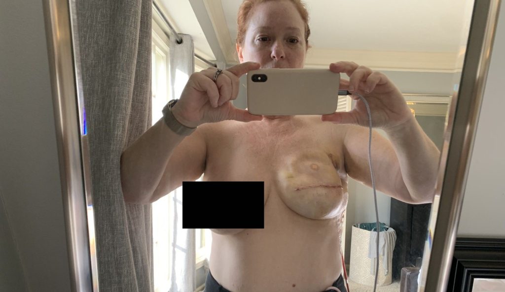 Woman who was told she may not live a year has beaten cancer an incredible six times - surviving melanoma, thyroid, breast and skin cancer to now run half marathons.