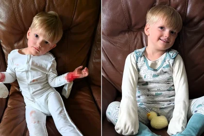 Heartbroken mum reveals her three-year-old son kept waking up covered in blood from bone-deep eczema itch - until specialist pyjamas with built-in mittens changed everything.