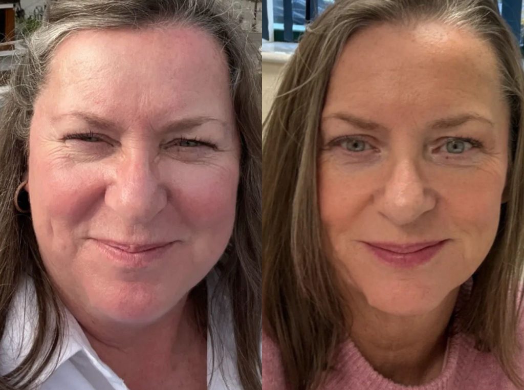 Woman who secretly took Mounjaro - even hiding the jabs in her fridge veg tray - has come clean after shedding eight stone and reversing her pre-diabetes diagnosis before turning 60.