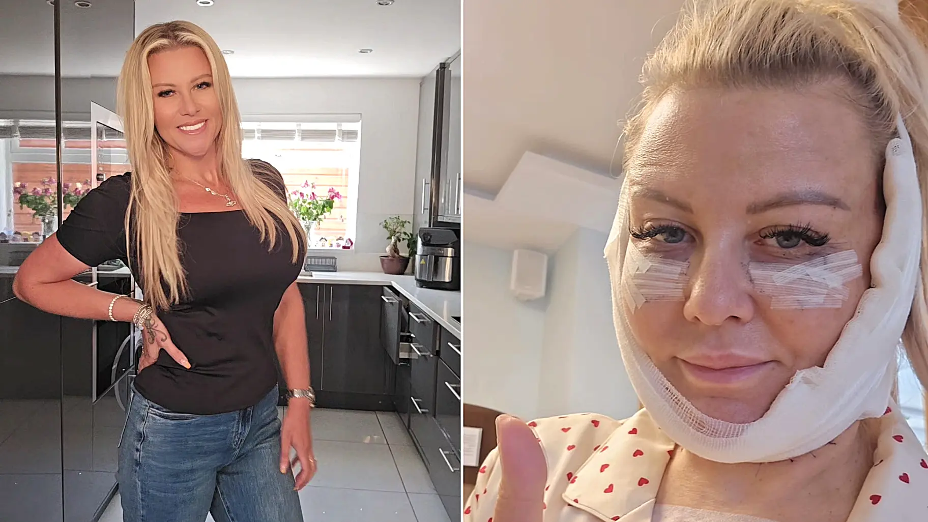 ‘I'm like Frankenstein's bride after a FULL BODY makeover - eyelids and all’