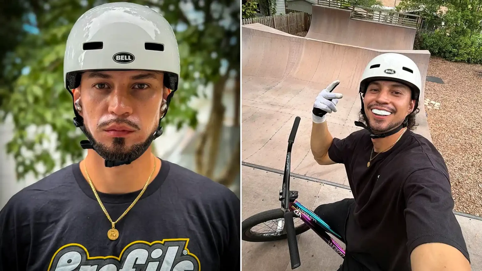Colombian BMX star Robin Meza was left fighting for his life after a horror training crash in Paris - with his family now facing hospital bills of almost £3,900 a day.
