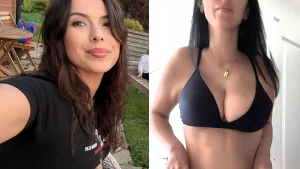 A woman born with missing chest muscles has worn a bikini for the first time after £16,000 surgery - having quit swimming lessons in tears as a schoolgirl.