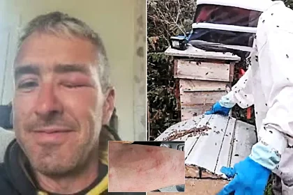 A carpenter looked like he had been beaten up with swellings all over his body after an angry bee swarm viciously attacked him - stinging him over 60 times.
