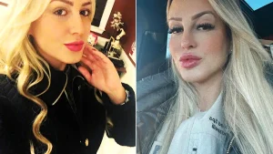 A fake nurse who pocketed $1million from 2,000 bogus Botox jobs has been jailed - after clients suffered facial paralysis, double vision and infections.