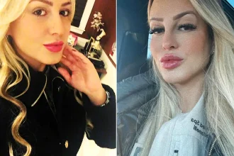 A fake nurse who pocketed $1million from 2,000 bogus Botox jobs has been jailed - after clients suffered facial paralysis, double vision and infections.