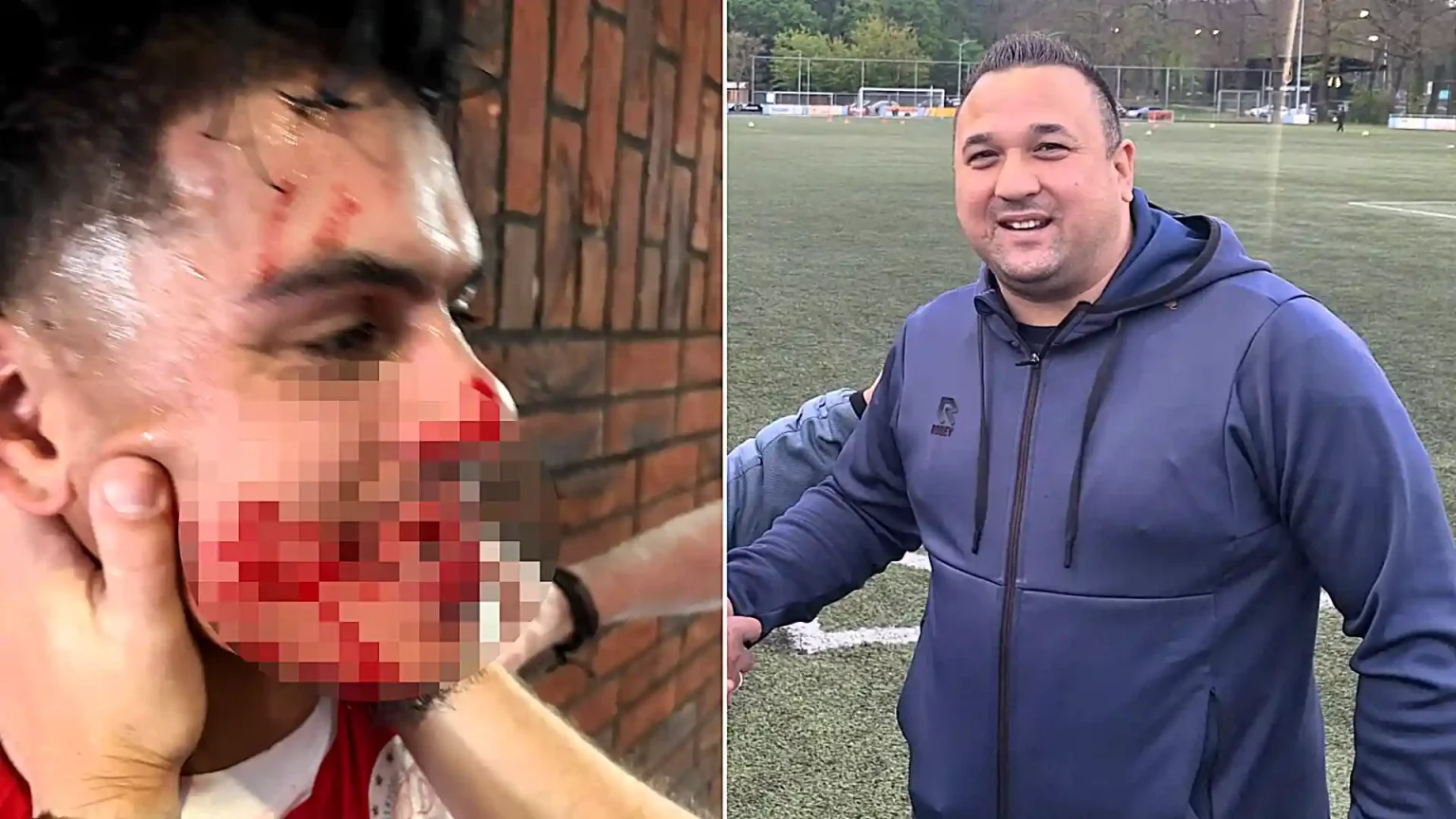 A footballer was left with seven broken teeth after allegedly being punched by a rival assistant manager in the tunnel - with police forced to restore order.