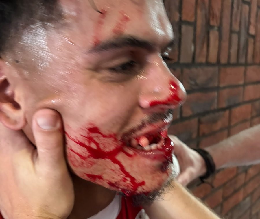 A footballer was left with seven broken teeth after allegedly being punched by a rival assistant manager in the tunnel - with police forced to restore order.