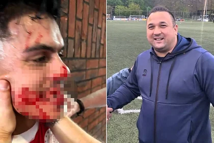 A footballer was left with seven broken teeth after allegedly being punched by a rival assistant manager in the tunnel - with police forced to restore order.