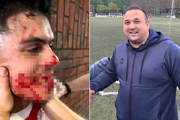 A footballer was left with seven broken teeth after allegedly being punched by a rival assistant manager in the tunnel - with police forced to restore order.