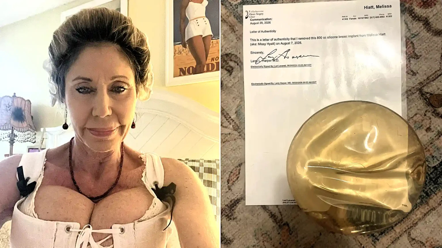 An ex-WWE legend is auctioning off one of her old breast implants for £1,000 - telling fans it is their chance to "hold" her, complete with a certificate.