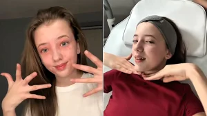 A sleepover skincare session left Sienna, 14, with red blotches and itchy eyelids for months - all because the anti-ageing products "looked cute"
