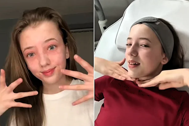A sleepover skincare session left Sienna, 14, with red blotches and itchy eyelids for months - all because the anti-ageing products "looked cute"