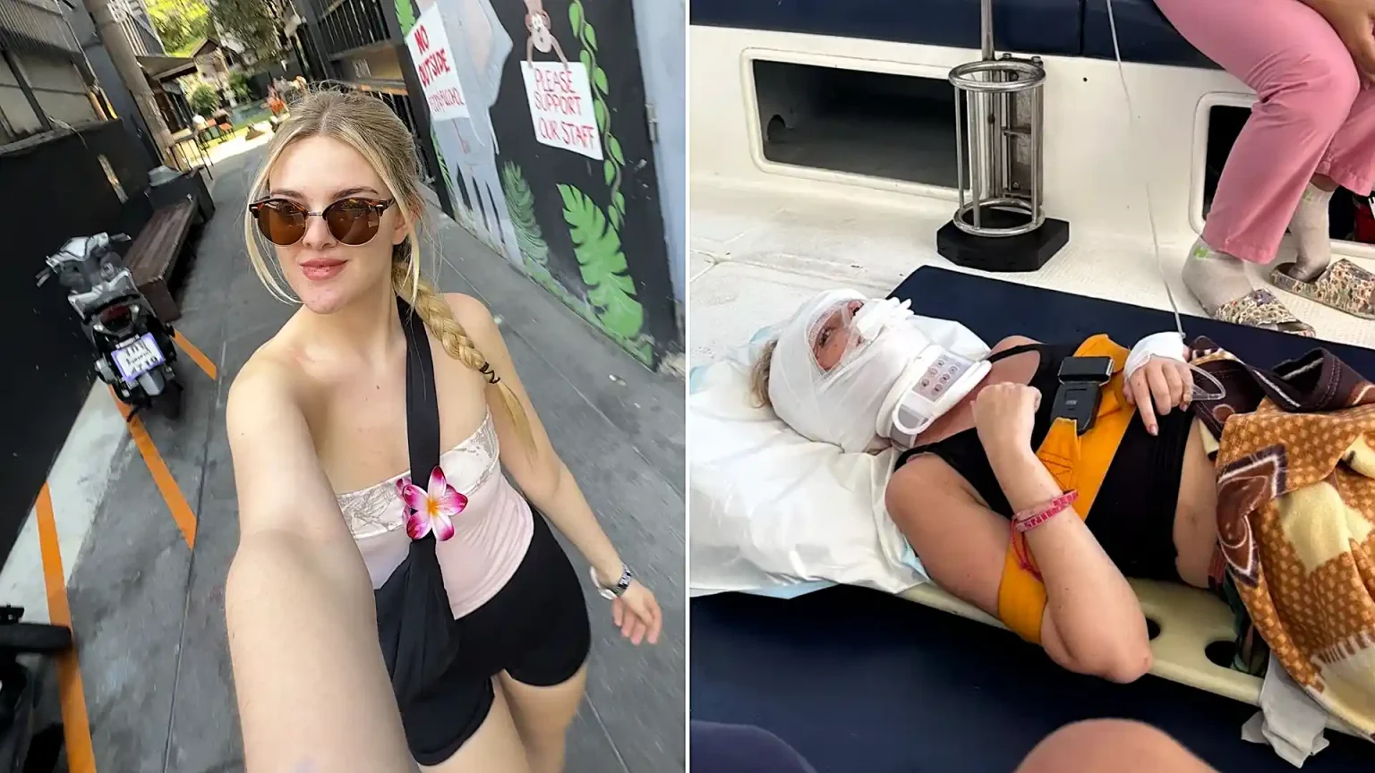 Tia Lockey's dream Asia trip was ruined at the start when a motorbike crash in Thailand shattered her jaw in two places - leaving her with no feeling in her face.