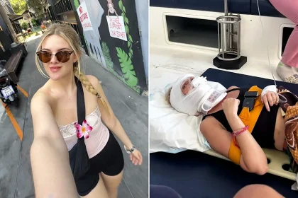 Tia Lockey's dream Asia trip was ruined at the start when a motorbike crash in Thailand shattered her jaw in two places - leaving her with no feeling in her face.