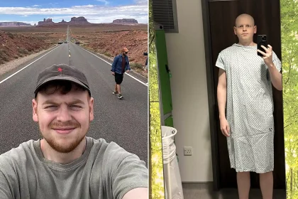A student who blamed three years of leg pain on gym workouts found out he had a rare cancer via an NHS app notification while sat in Starbucks - and has since had seven surgeries.