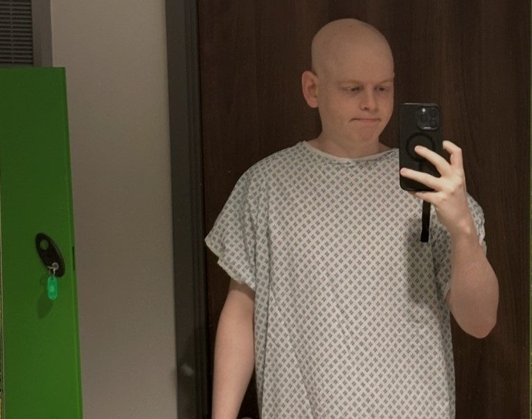 A student who blamed three years of leg pain on gym workouts found out he had a rare cancer via an NHS app notification while sat in Starbucks - and has since had seven surgeries.