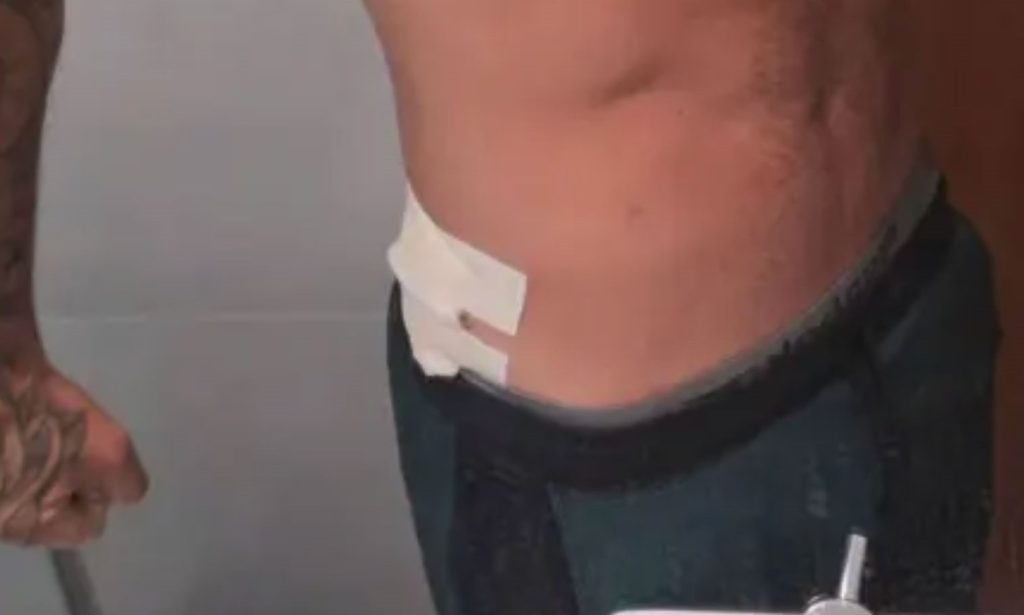 An MMA fighter was shot twice in the bum at an amateur football match after a video he posted allegedly angered a rival faction in his own ultra firm.