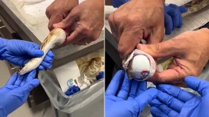 A snake left vets stunned after swallowing three golf balls, which were removed without surgery at a Texas exotic animal hospital in footage viewed over five million times.