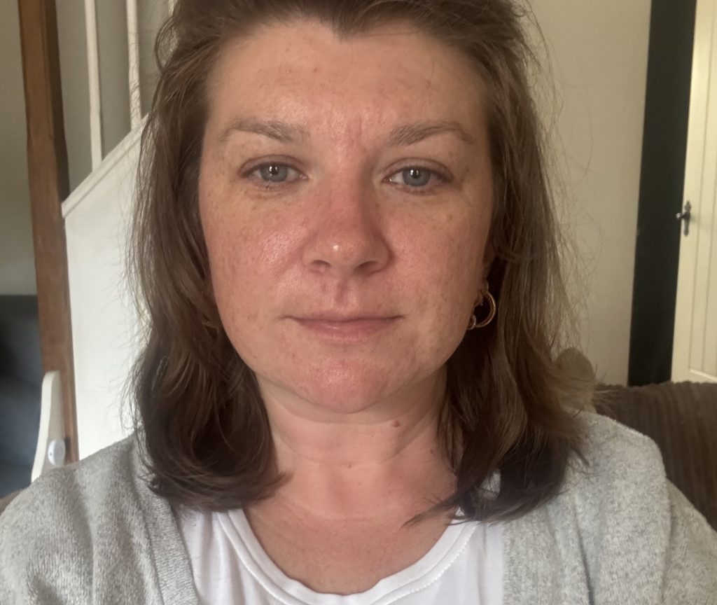 Teaching assistant Fi Styles called in sick after pupils mocked her acne - then a £16 serum cleared her skin completely in six months.